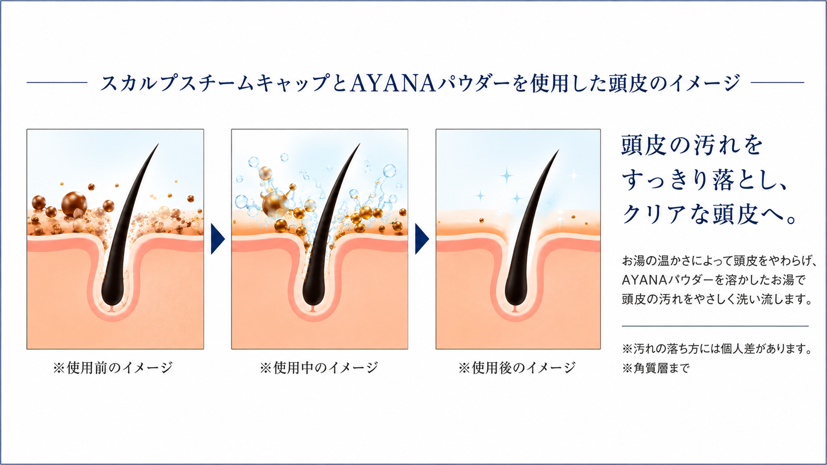 スカルプスチームキャップとAYANAパウダーを使用した頭皮のイメージ